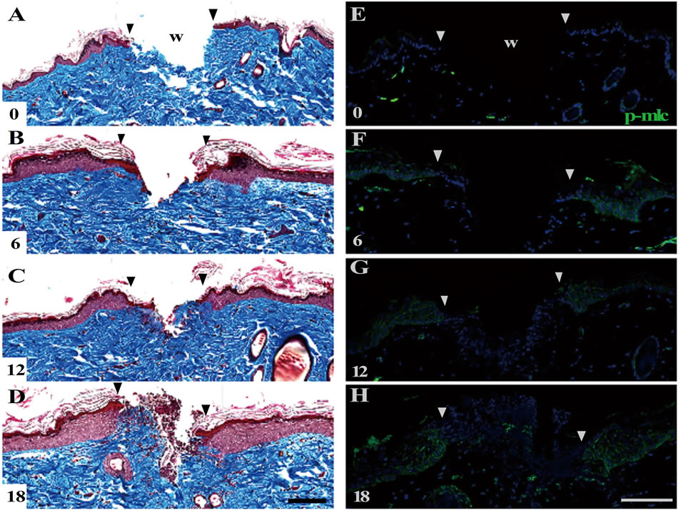 Wound Closure on the Neonatal Rat Skin II. The Potential Ability of