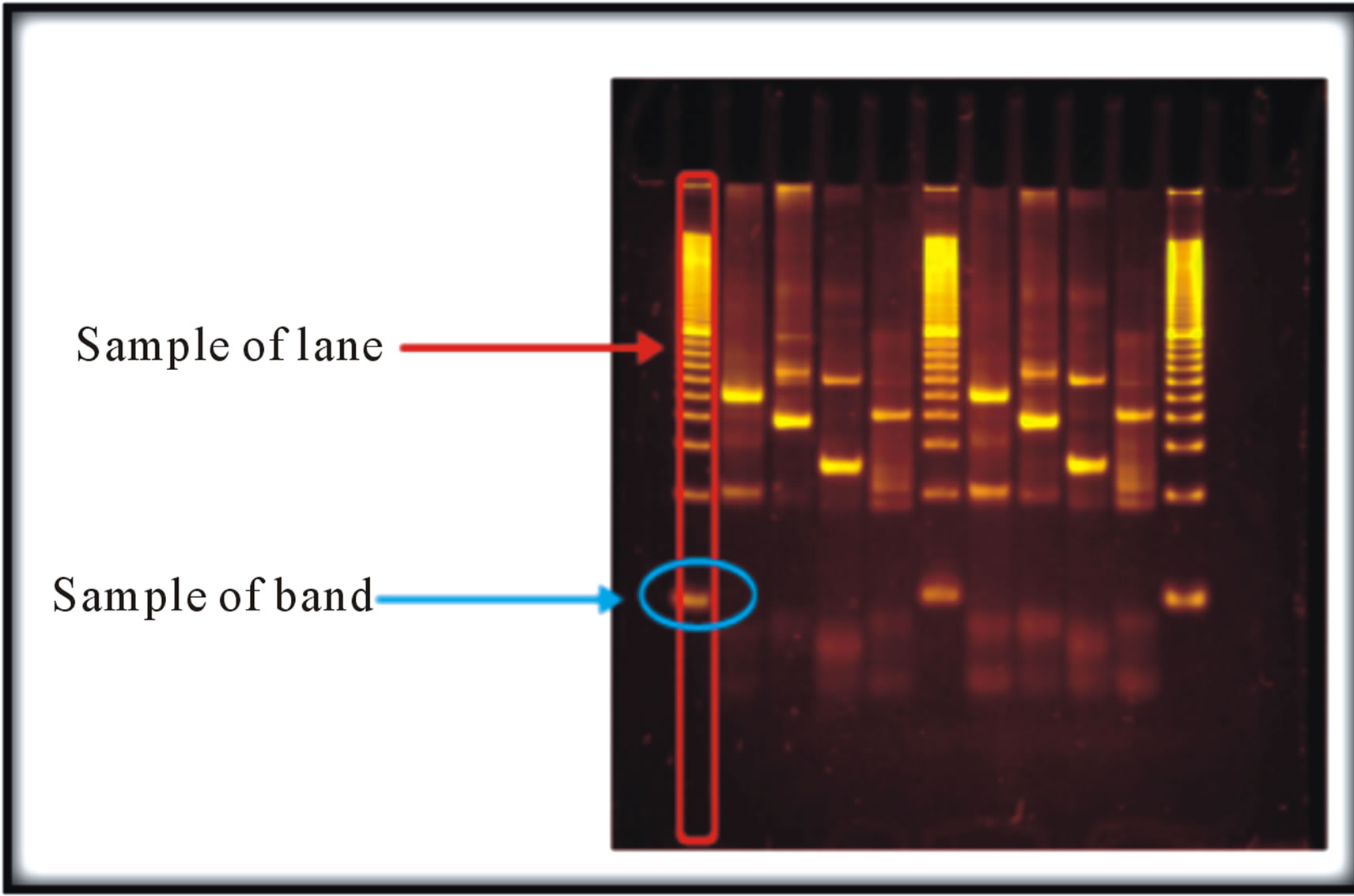 Semiautomatic detection of lanes and bands in DNA gel electrophoresis