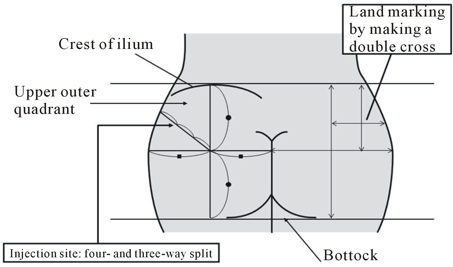 1000+ images about Nursing Skills on Pinterest Nursing Care Plan