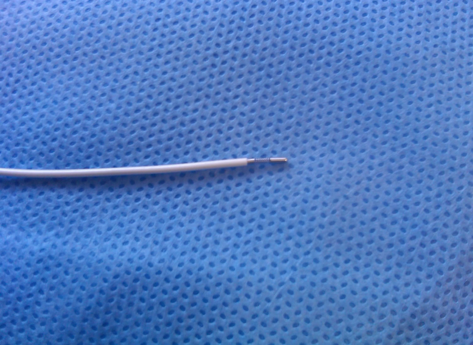 The Difficulty to Remove Perineural Catheter A Technique for Removing