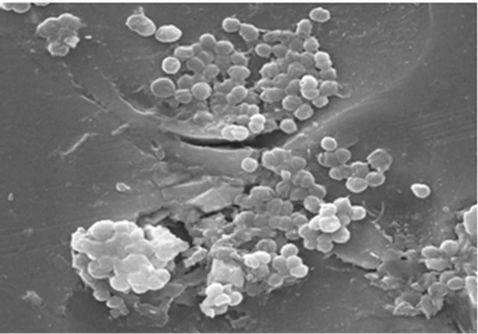 enterococcus faecalis csíraszám 10 4 1