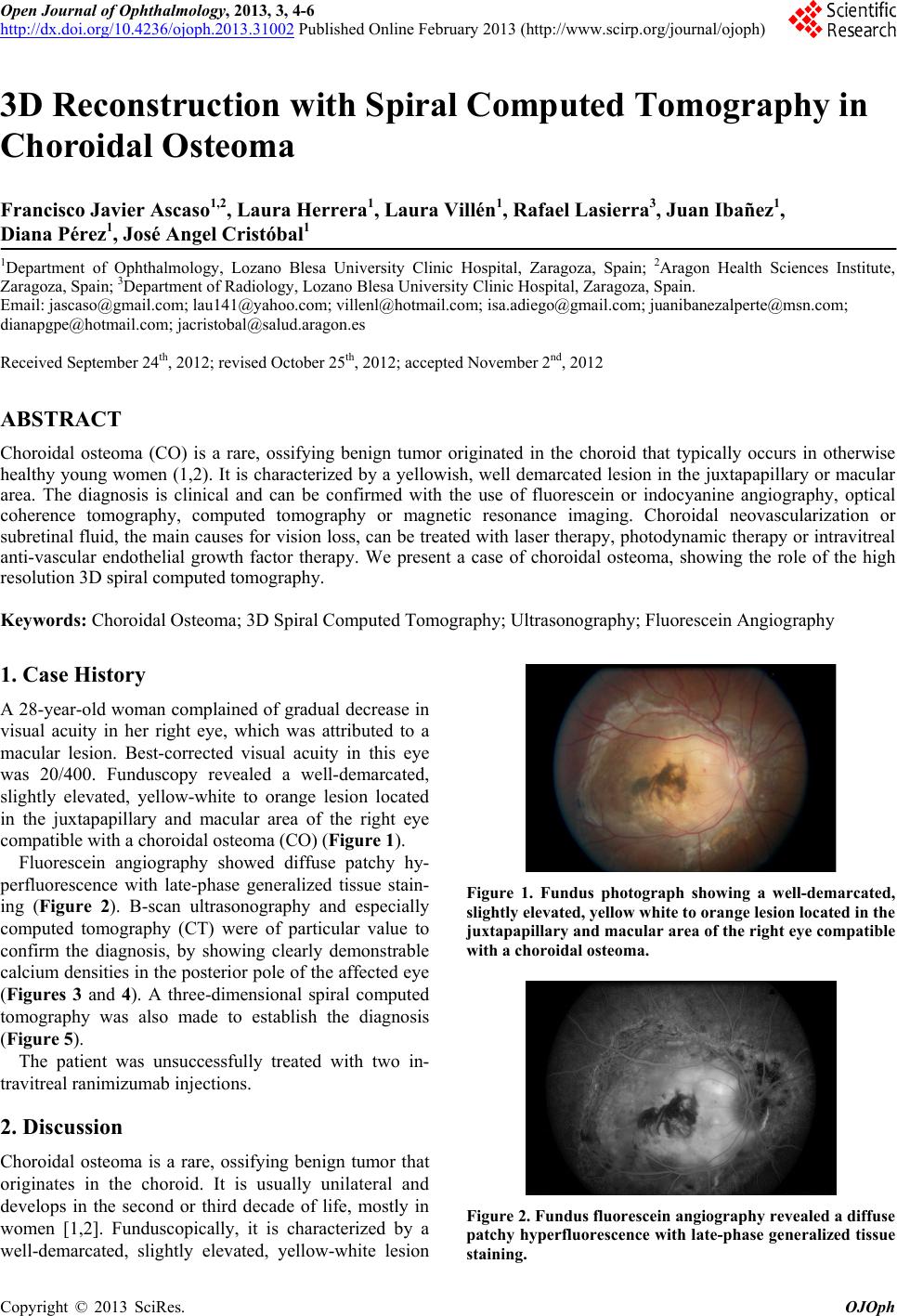 photo essay ophthalmology journal International journal of ophthalmology-ijo (english edition) is a global ophthalmological scientific publication and a peer-reviewed open access periodical. photo essay ophthalmology journal International journal of ophthalmology-ijo (english edition) is a global ophthalmological scientific publication and a peer-reviewed open access periodical.