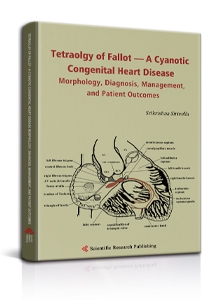 Tetraolgy of Fallot—A Cyanotic Congenital Heart Disease