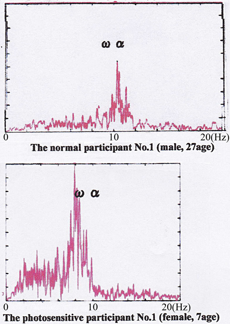 Photostimulation effect on the human EEG alphawave spectrum