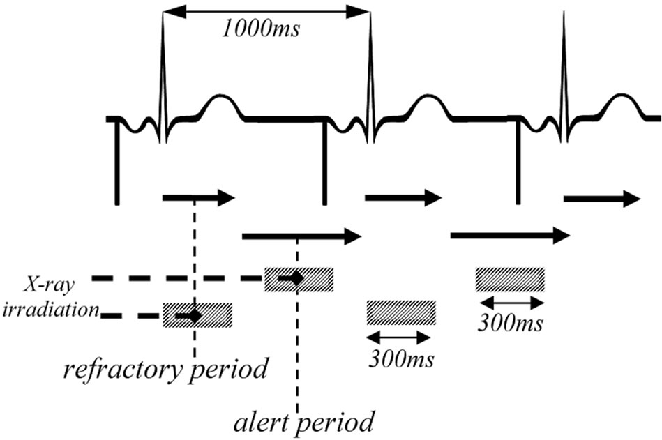 Inhibition of the Oversensing of Cardiac Pacemakers in Chest CT