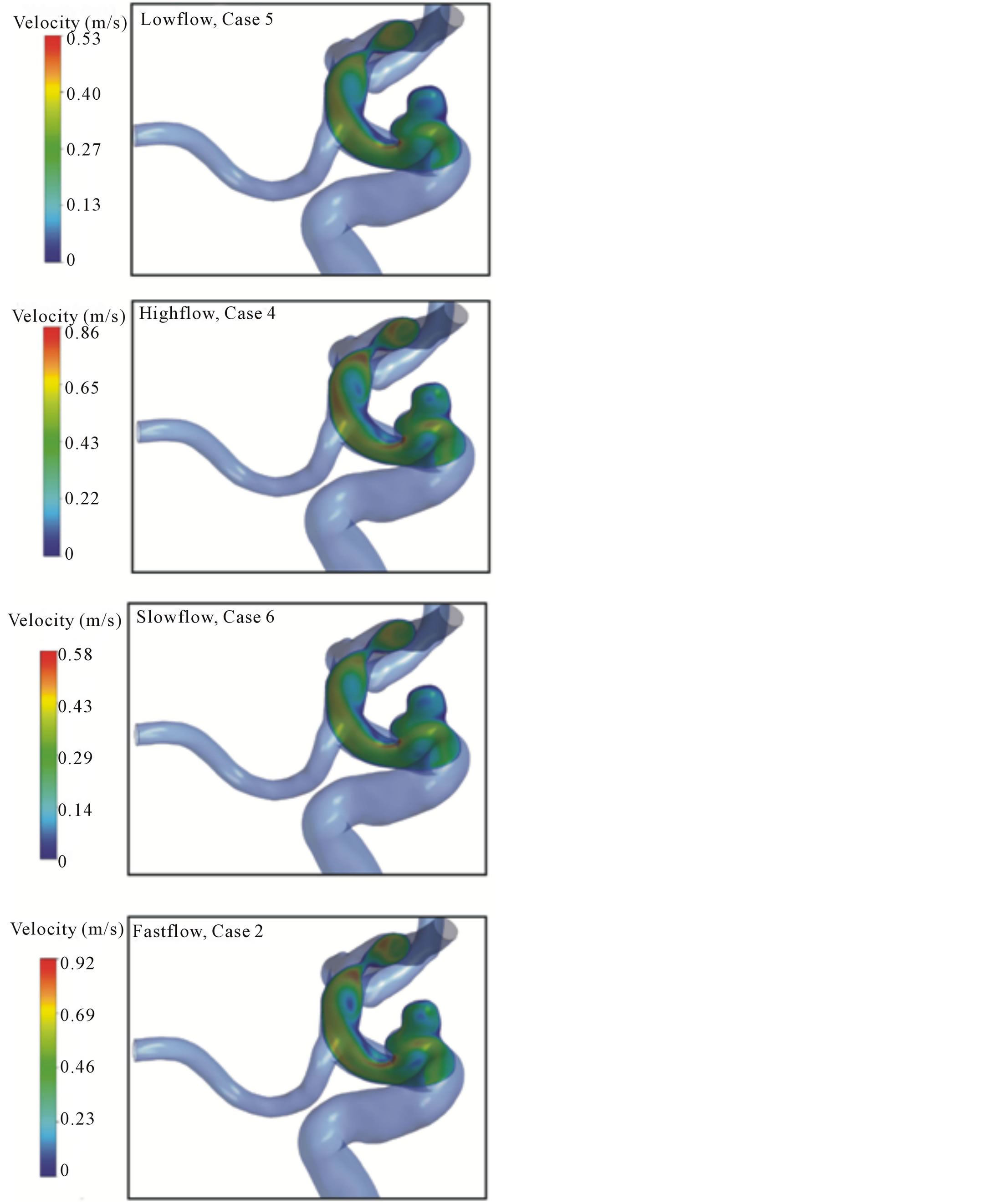 Impacts of waveforms on the fluid flow, wall shear stress, and flow ...