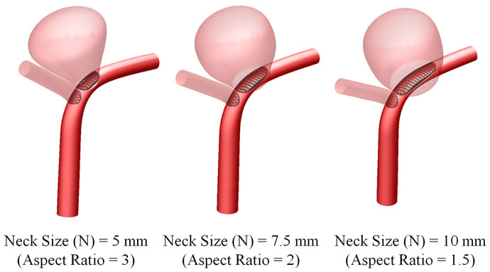 Influence of the aspect ratio on the endovascular treatment of ...
