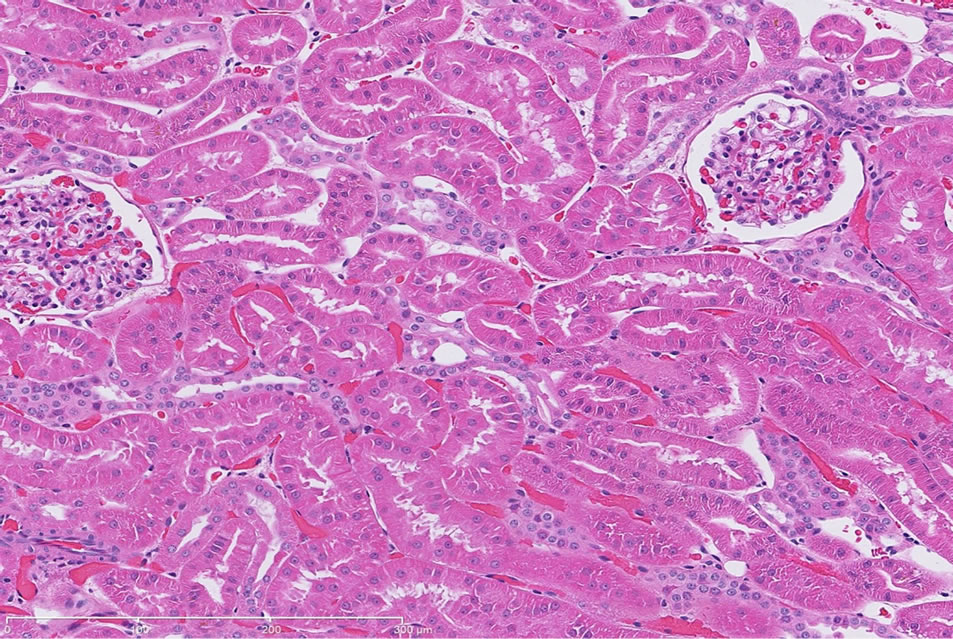 Novel genomic biomarkers for acute gentamicin nephrotoxicity in dog