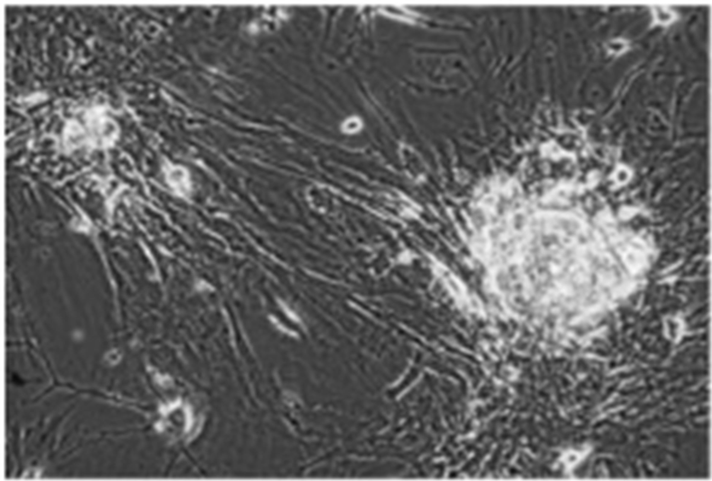 HighFat DietsInduced Metabolic Alterations Alter the Differentiation
