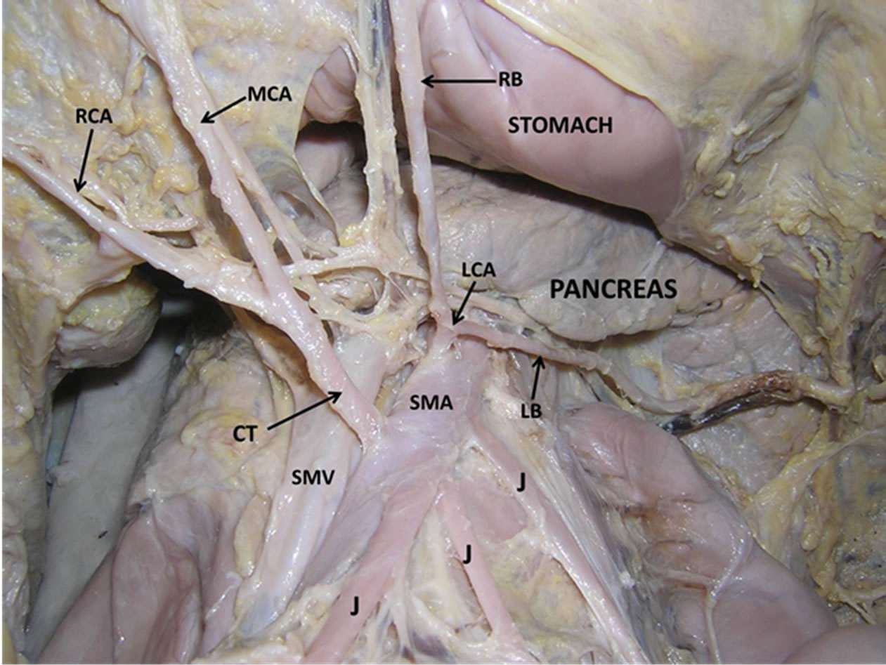 Anomalous origin and vulnerable course of left colic artery in relation