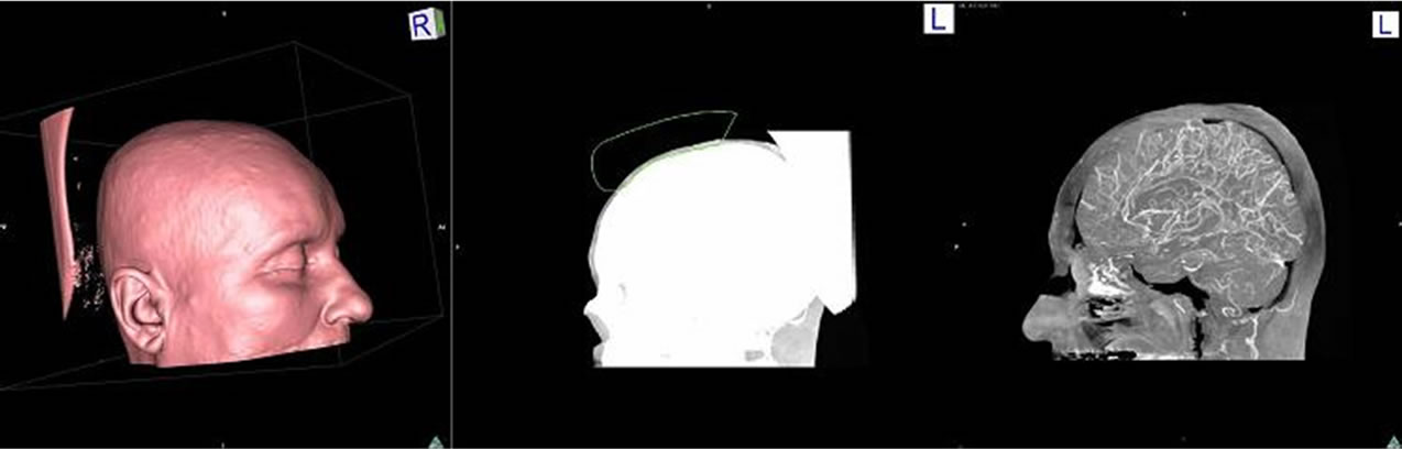 Framework for development of three-dimensional digital atlas of human ...