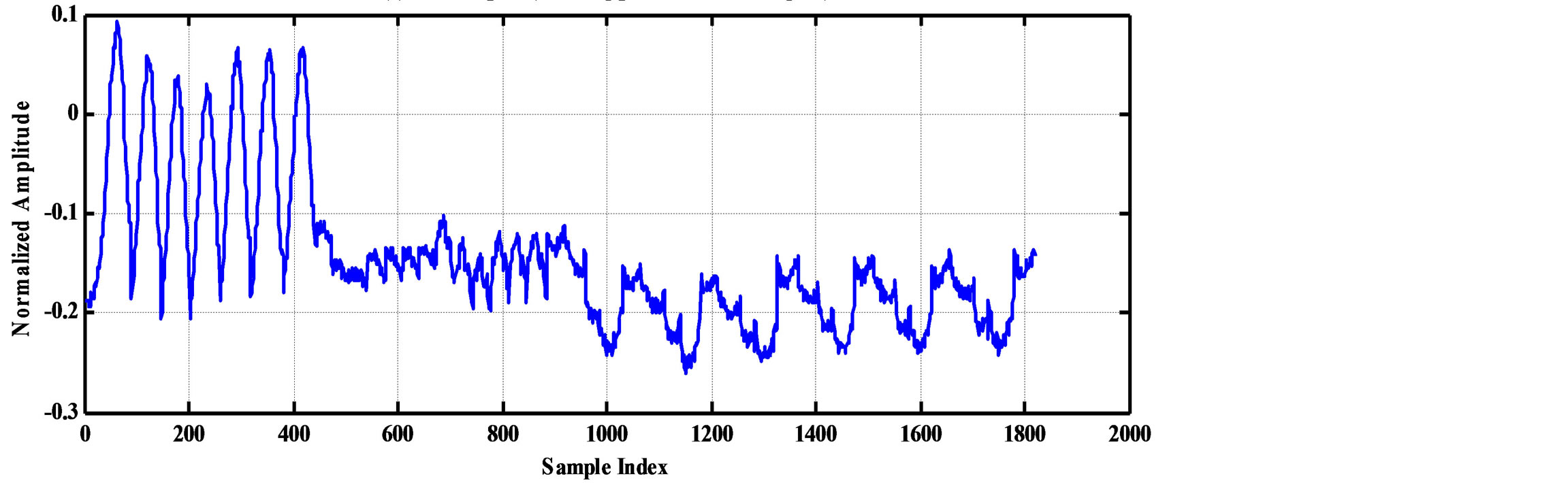 Compression of ECG Signals Based on DWT and Exploiting the Correlation ...