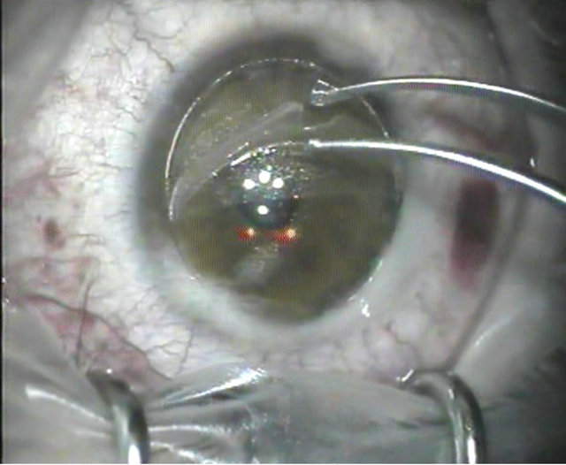 Flaporhexis Alternative Way to Make a Femtosecond Laser