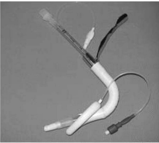 Use of Laryngeal Mask Airway in the Management of a Difficult Airway A