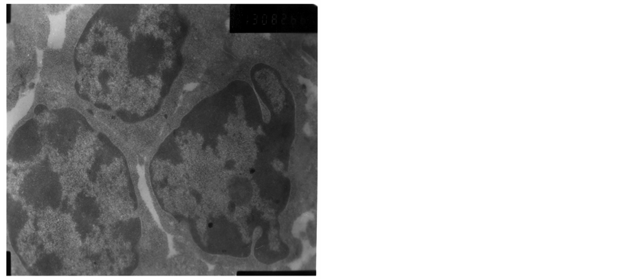 Analysis of Chicken T Cell-Mediated Responses on Thymus after Immune Stress