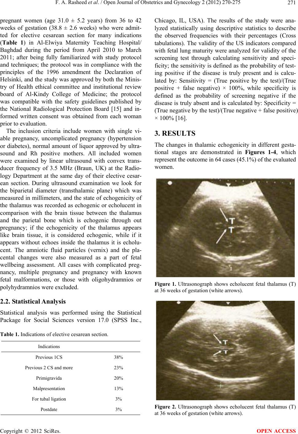 Evaluation of thalamus echogenicity by ultrasound as a marker of fetal ...