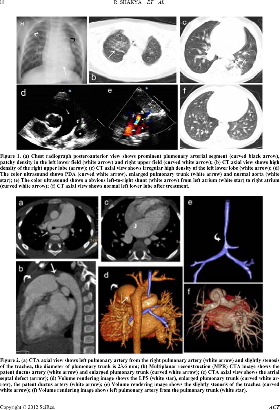 Left Pulmonary Artery Sling Associated with Patent Ductus Arteriosus ...