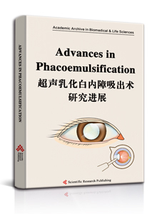 Advances in Phacoemulsification