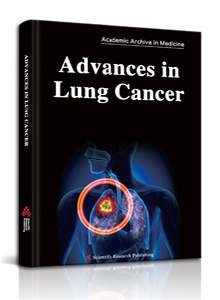 Advances in Lung Cancer