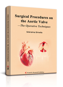 Surgical Procedures on the Aortic Valve—The Operative Techniques