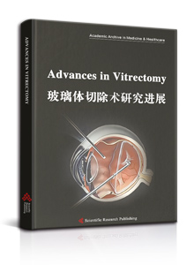 Advances in Vitrectomy